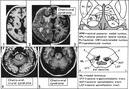 fig 2.