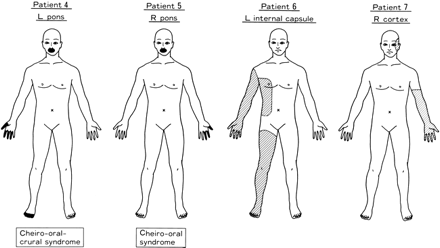 fig 3.