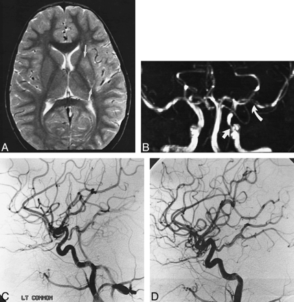 fig 5.