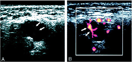 fig 4.