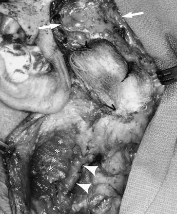 fig 3.