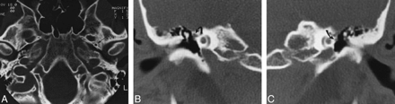 fig 4.