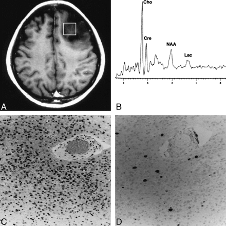 fig 2.