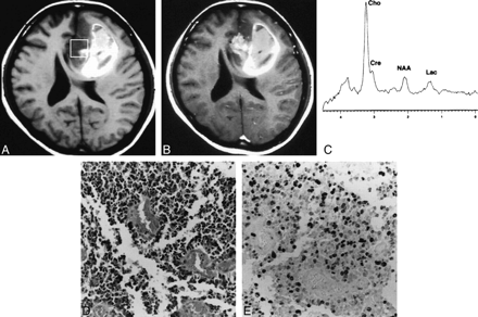 fig 4.