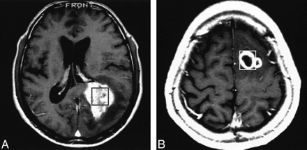 fig 5.
