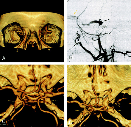 fig 2.