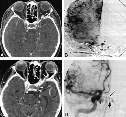 fig 4.