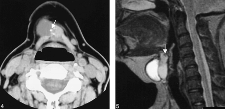 fig 4.