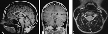 fig 1.