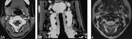 fig 3.
