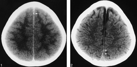 fig 1.