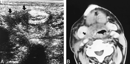 FIG 4.