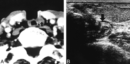 FIG 5.