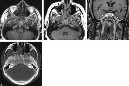 fig 3.
