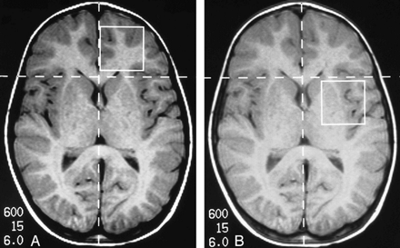 fig 1.