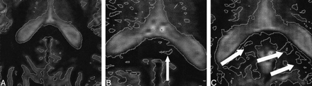 fig 3.