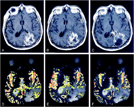 fig 1.