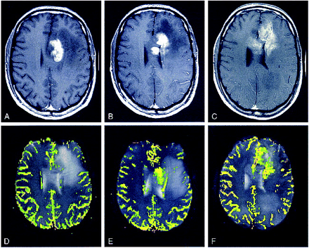 fig 3.