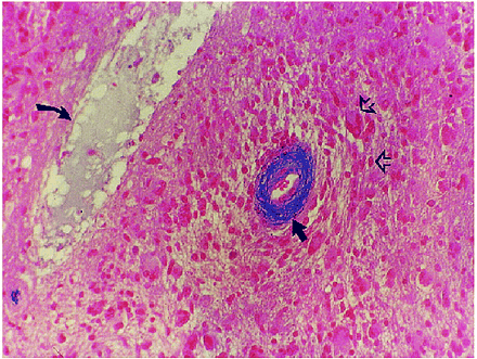 fig 7.