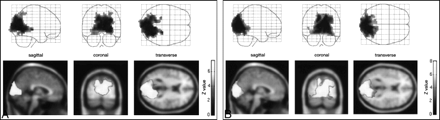 fig 1.