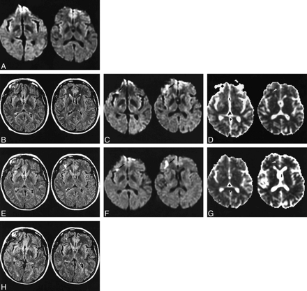 FIG 1.