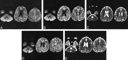 FIG 2.