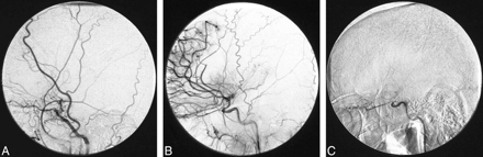 fig 1.