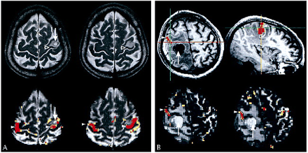 fig 1.