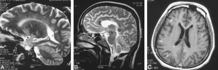 fig 4.