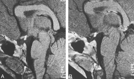 fig 2.