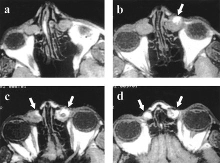 fig 3.