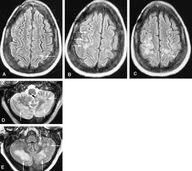 fig 2.