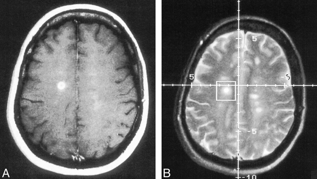 fig 1.