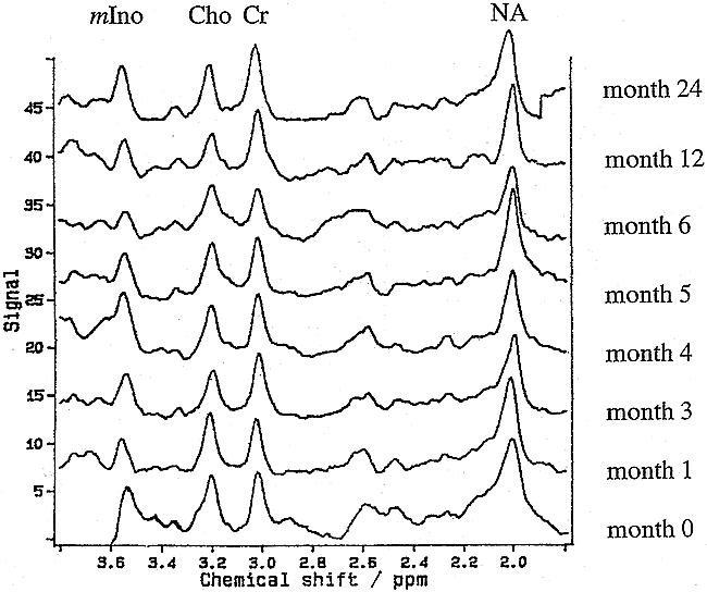 fig 2.