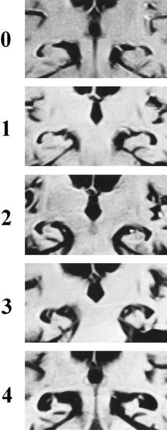 fig 1.