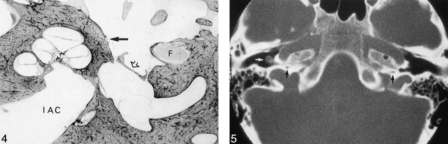 fig 4.