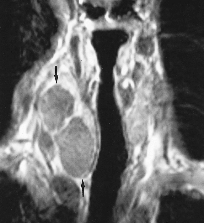 fig 4.