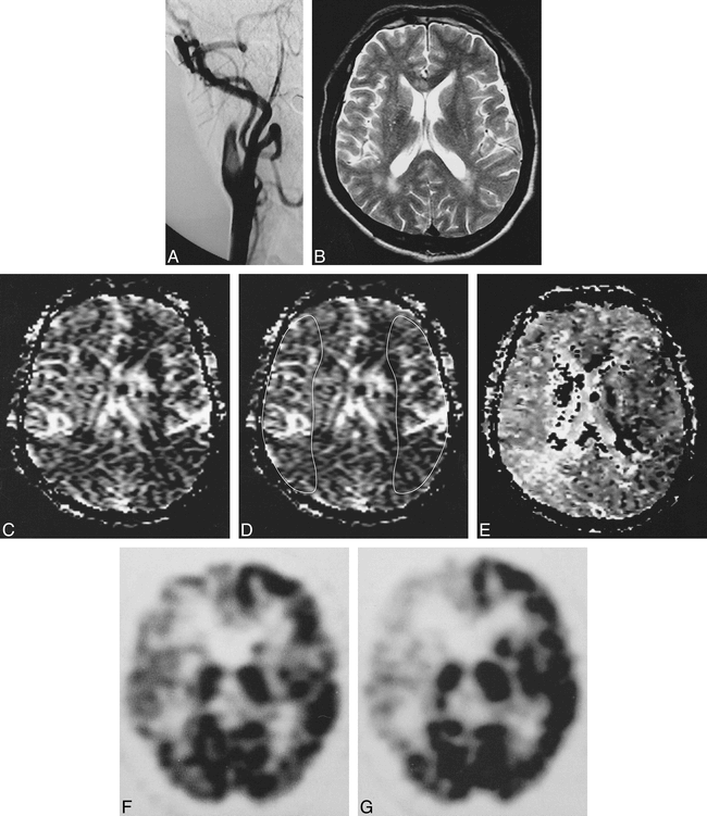 fig 2.