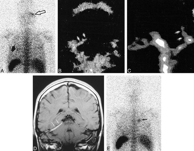 fig 3.