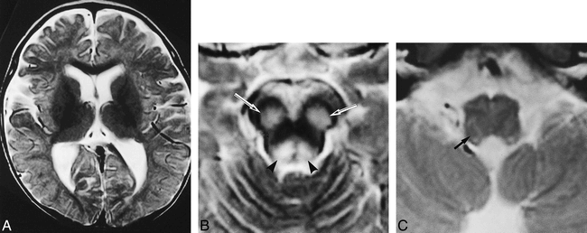 fig 3.