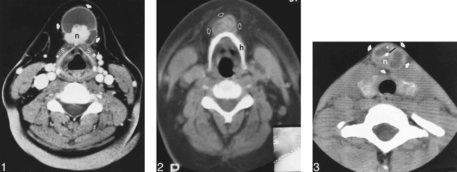 fig 3.