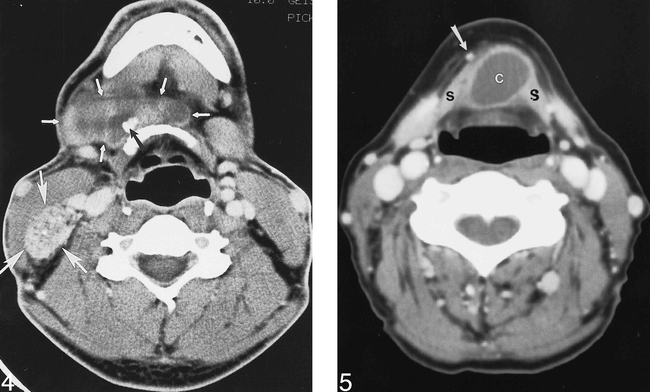 fig 4.
