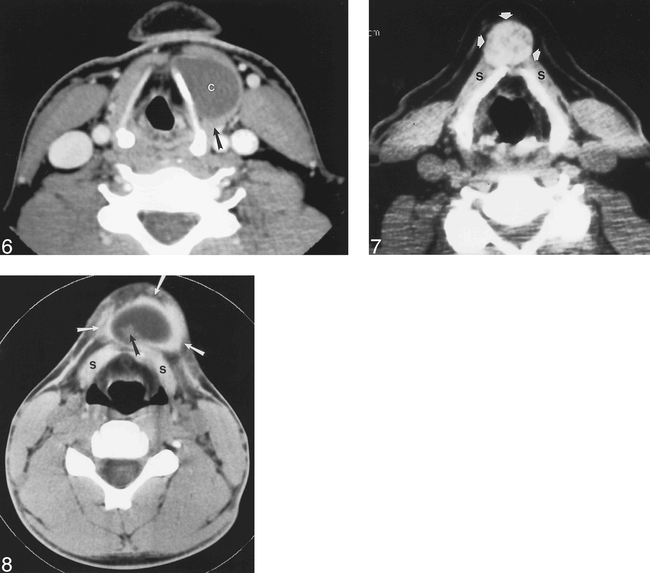 fig 6.