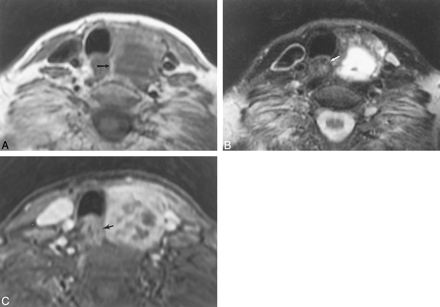 fig 1.