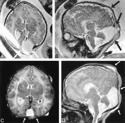 fig 3.