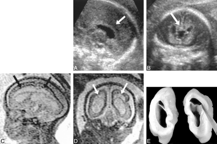 fig 4.