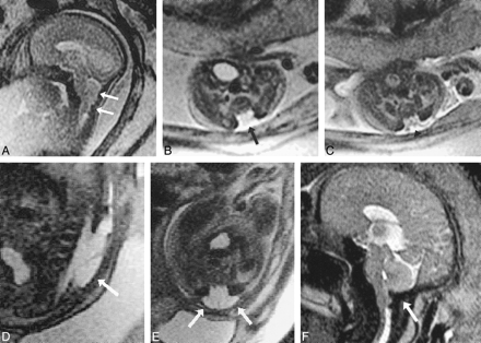 fig 6.