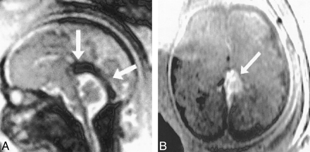 fig 7.