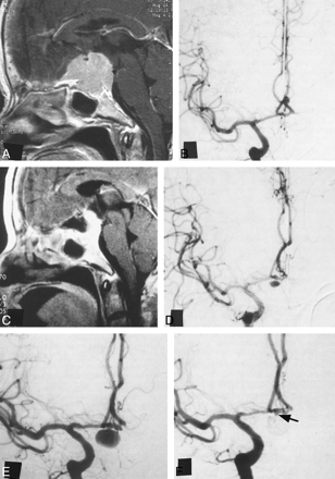 fig 2.