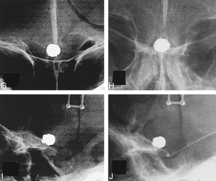 fig 2.